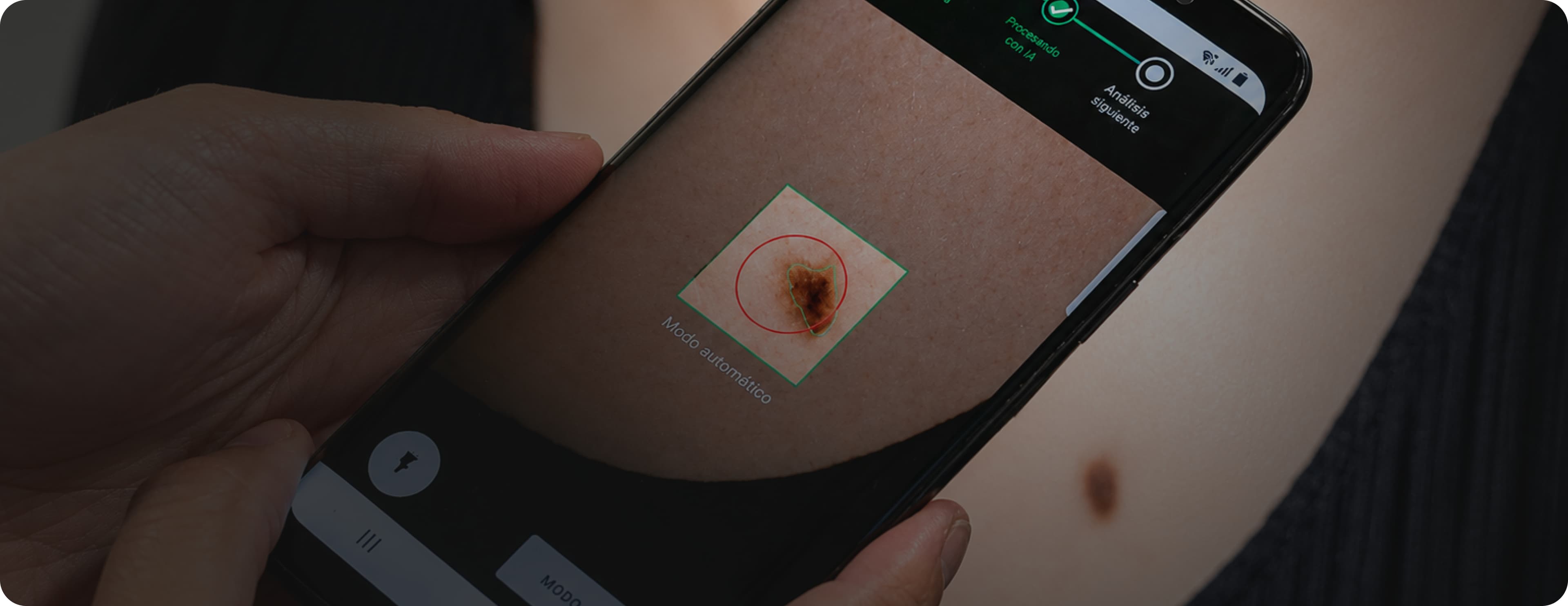 AI-Powered Skin Cancer Detection Apps: Development Guide 2026