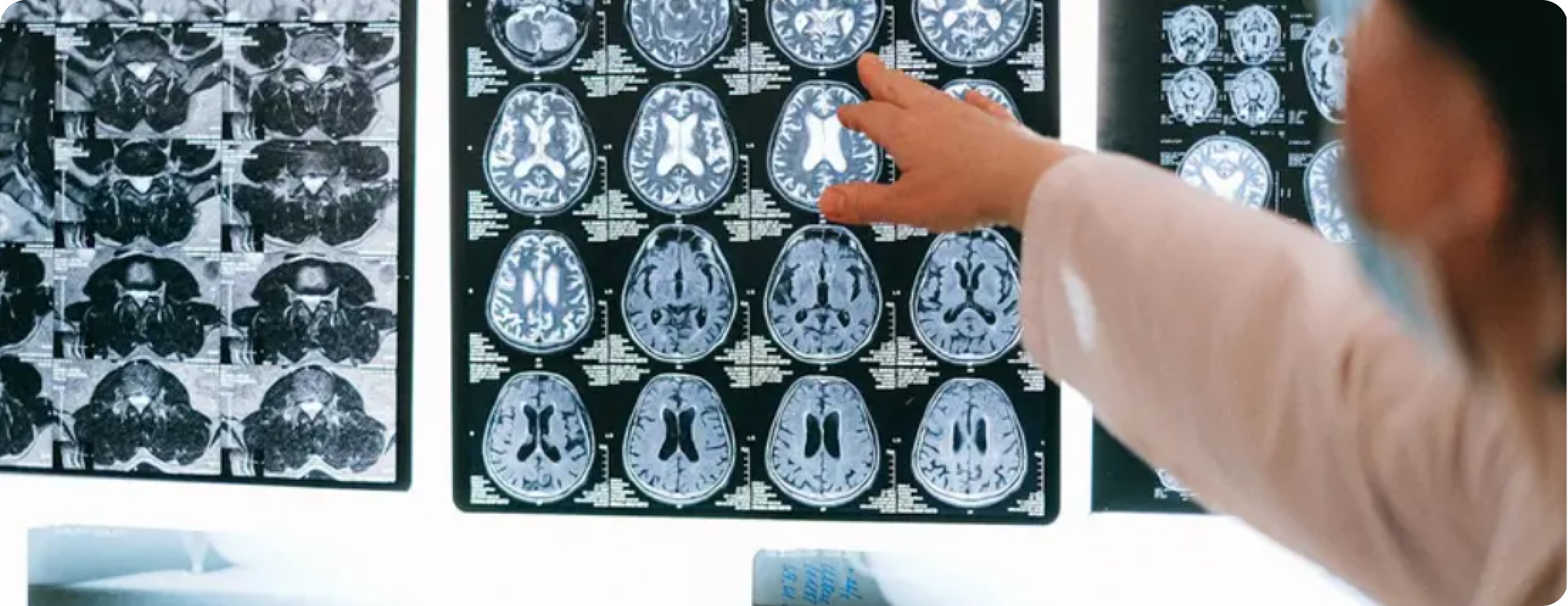 Discover how AI-powered Radiology Information Systems streamline workflows, boost reporting speed, and ensure HIPAA compliance in 2026.